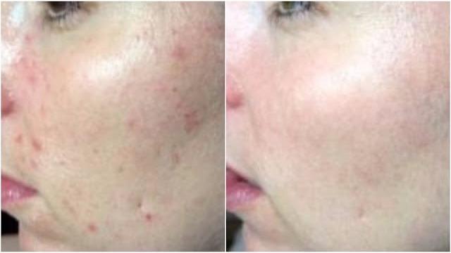 PELE LISA E MACIA – COMBATA RUGAS E MANCHAS – REJUVENESCIMENTO IMEDIATO