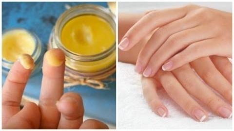 Como rejuvenescer as mãos com um tratamento 100% natural