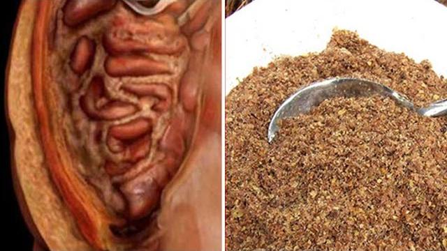 Como emagrecer rápido e eliminar os vermes e parasitas com 2 ingredientes naturais