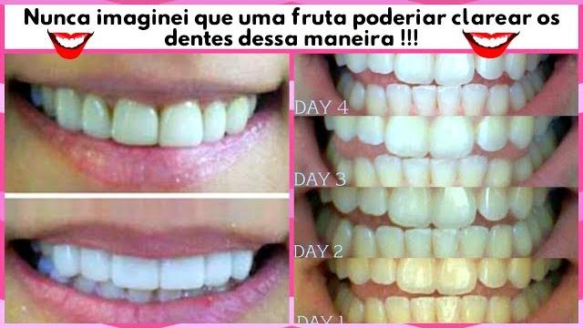 Nunca imaginei que uma fruta tivesse esse poder de clareamento dentário
