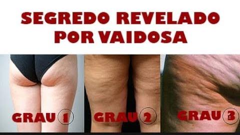 EXTERMINE A CELULITE HOJE COM AS DICAS DE VAIDOSA LONDRINA Por Nina Della Rosa