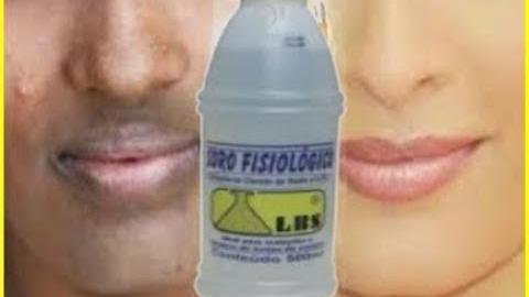 Remova Manchas da Pele, Rugas e Marcas de Melasma -Basta Isto