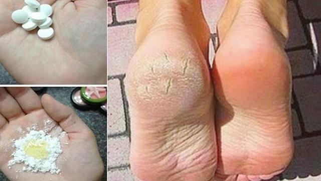 PASSE ASPIRINA NOS PÉS Por 3 Dias – O Que Vai Acontecer Vai te Deixar Chocado