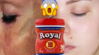 Pele de Bebê em 2 Dias – Use Para Remover Manchas e Rugas da Pele