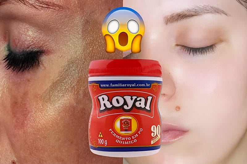 Pele de Bebê em 2 Dias – Use Para Remover Manchas e Rugas da Pele