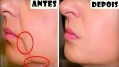 Receita Caseira Para Tirar Rugas e Manchas – Estimula o Colágeno