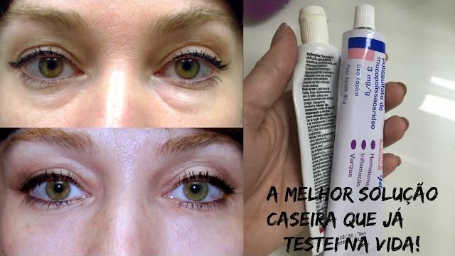 Mistura Milagrosa Para Acabar com as Olheiras