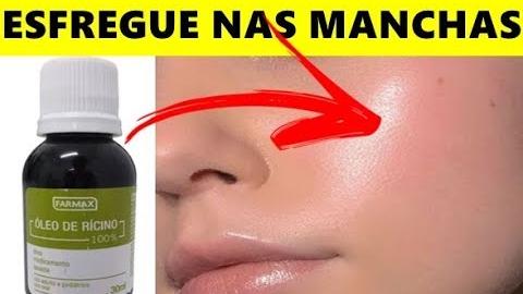 CLAREIA DEMAIS A SUA PELE – MELHOR QUE PLÁSTICA NO ROSTO