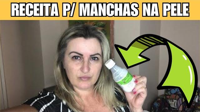 Curei o Melasma só Usando Isso