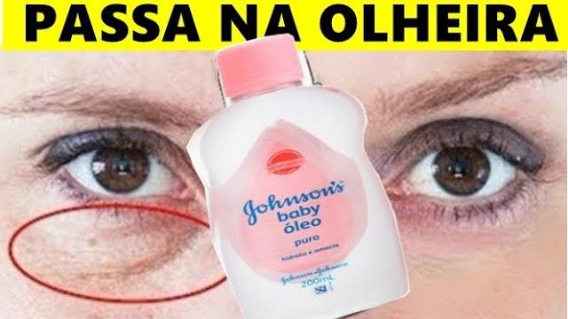 Isto é Melhor  que plástica na Área dos Olhos – Olheiras e Pálpebras Caídas