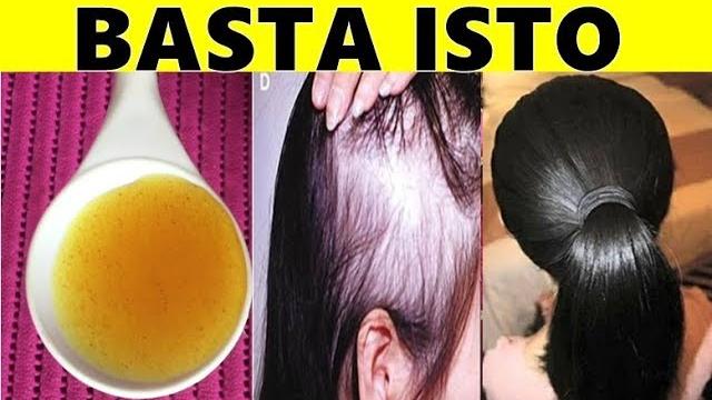 Fiz Isso e meu Cabelo Voltou a Nascer