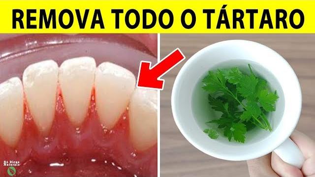 Isso Tira o Tártaro e Limpa os Dentes Muito Rápido