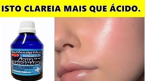 Melhor que Ácido – Clareia a Pele e Estica  em 2 Dias
