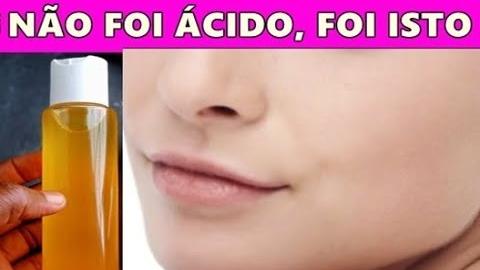 USE A NOITE nas OLHEIRAS, BIGODE CHINÊS e MANCHAS do ROSTO – É MELHOR QUE ÁCIDO