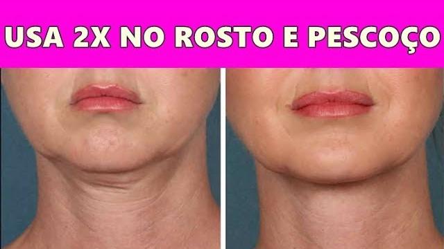 Isso Tira Manchas da Pele e Renova a Pele