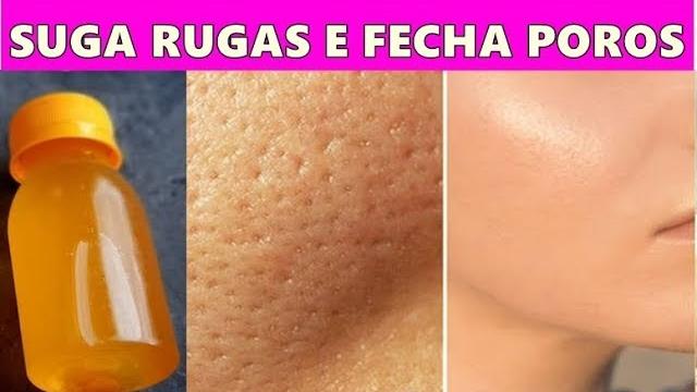 Misturinha Sugador de Rugas