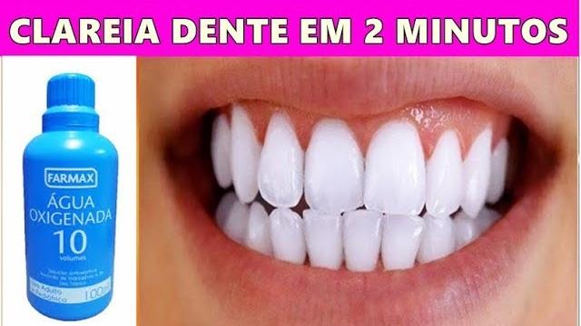 Clareia seus Dentes Com esta Misturia Caseira