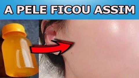 Aprenda Eliminar Rugas e Manchas da Pele Com Isso