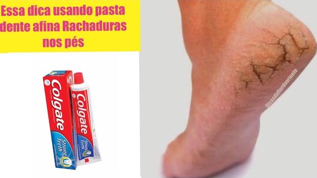 Uma Dica Excelente Para Afinar seus Pés e Acabar Com Rachaduras