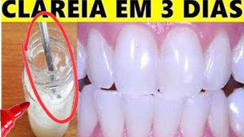 Como Deixar Seus Dentes Brancos