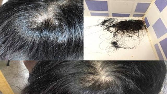 Poderoso Shampoo Anti-Queda – Uma Incrível Solução