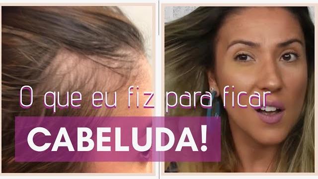 Como Melhorar a Queda de Cabelo e Conseguir Mais Volume Sem Usar Remédios