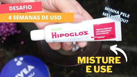 Hipoglós e Creme Nivea Como Usar Corretamente para Ter uma Pele Perfeita Livre de Rugas e Manchas