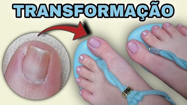 Aprenda a Transformar Suas Unhas dos Pés – Passo a Passo Completo