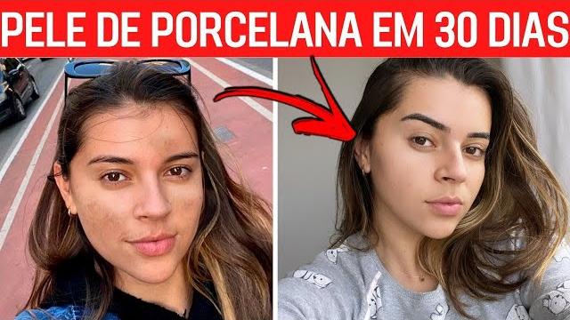 Pele de Porcelana e Sem Manchas em 30 Dias