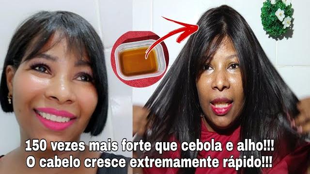 Seu cabelo vai crescer 5 vezes mais rápido – Livre-se da calvície rapidamente – Uma solução final